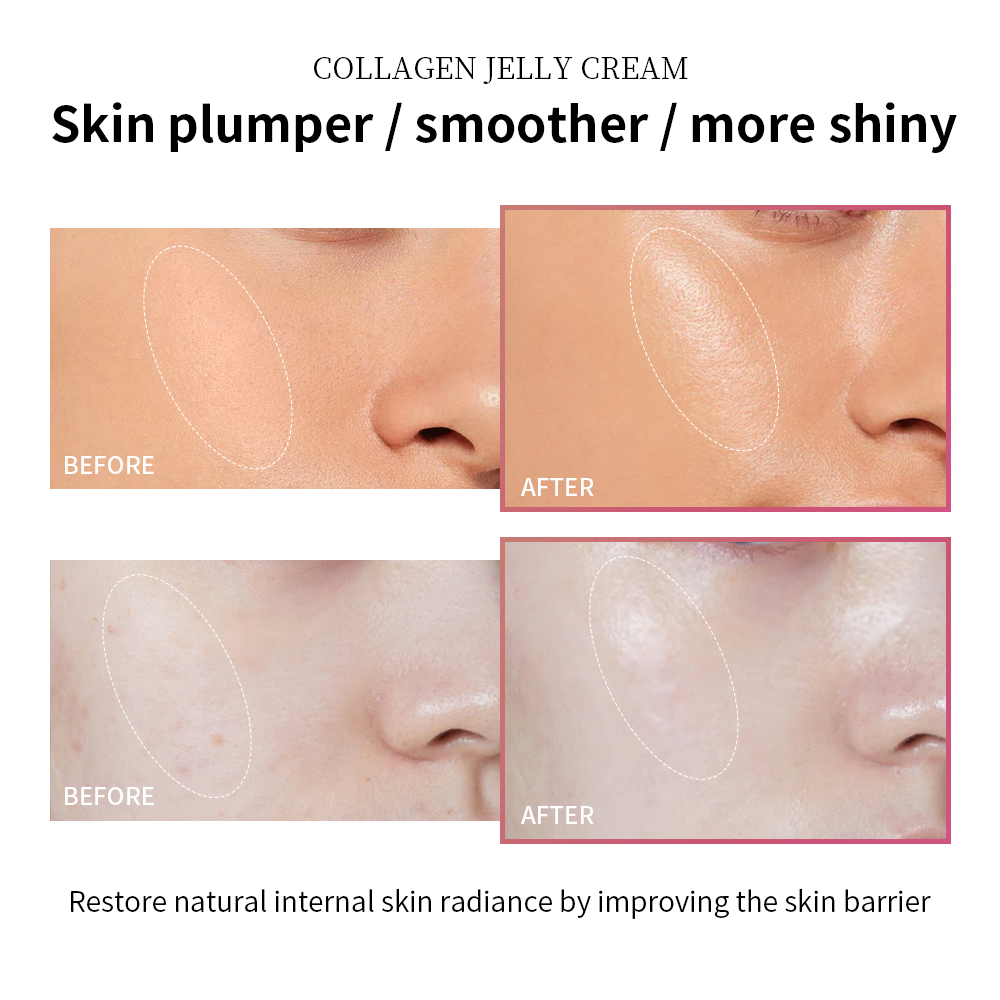 Moisturizing Collagen Jelly Cream
